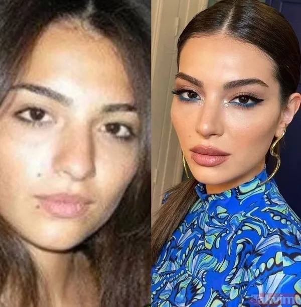 Esra Bilgiç estetik harikası çıktı! Eski halini görenin gözleri fal taşı gibi açıldı: Doğal sanıyordum! Diriliş Ertuğrul’un yıldızı... - 10