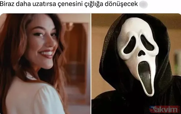 Dilan Çiçek Deniz'den 'yılandan korkmam yalandan korktuğum kadar' pozu! Estetik faciasıyla günlerce konuşulan Dilan - 10