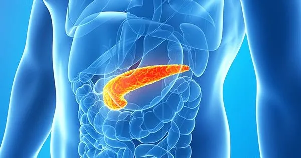 Pankreas kanserini yanlış anlama: Pankreas kanserinin belirtileri nelerdir?-3