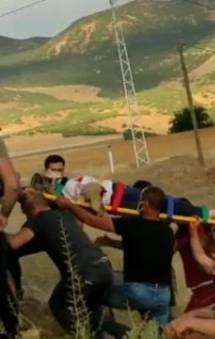 Metrelerce sürüklendi! Genç kızın kolu koptu