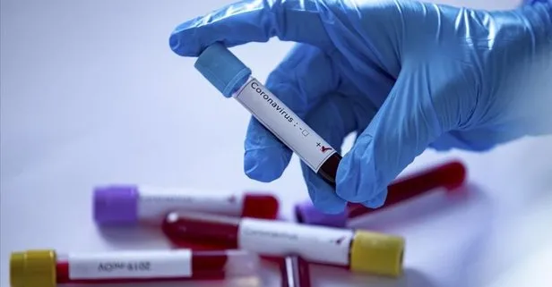 Korona Corona Testi Yapan Hastaneler Hangileri Korona Testi Nasil Yapilir Takvim