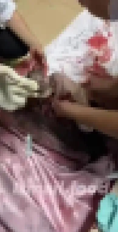 katliamin-golgesinde-yasamla-mucadele-anne-karninda-siyonist-teror-magduru-1698772460309.jpeg Katliamın gölgesinde yaşamla mücadele! Anne karnında siyonist terör mağduru | Doktorlar annesi şehit edilen bebeği kurtarmak için ter döktü-5