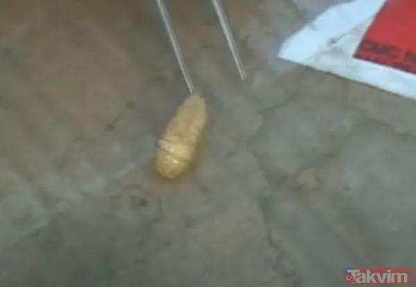 Karnındaki şişlik için gitti içinden çıkan doktorları bile şoke etti! Yer uzak değil Kayseri! 64 kilo girdi 55 kilo çıktı - 47