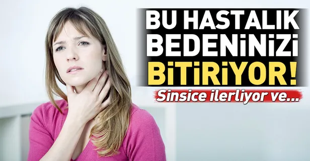 Haşimato tiroidi bitiriyor bedeni