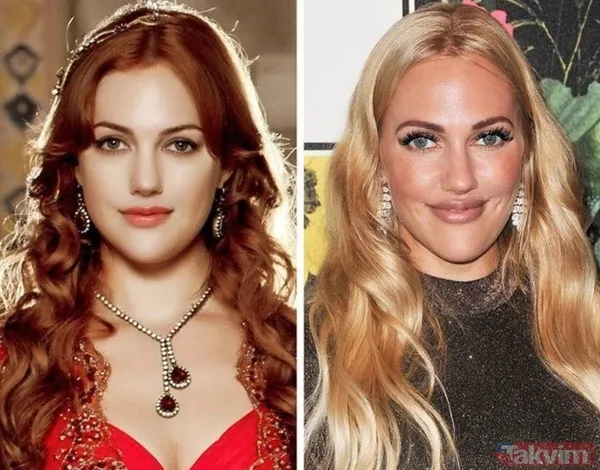 Esra Bilgiç estetik harikası çıktı! Eski halini görenin gözleri fal taşı gibi açıldı: Doğal sanıyordum! Diriliş Ertuğrul’un yıldızı... - 27