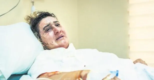 Eski eşini kızgın yağ ile yakan caniye 23 yıla kadar hapis istemi!