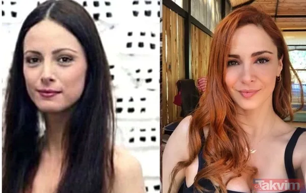 Esra Bilgiç estetik harikası çıktı! Eski halini görenin gözleri fal taşı gibi açıldı: Doğal sanıyordum! Diriliş Ertuğrul’un yıldızı... - 20