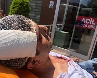 Son dakika haberi: Yeni Akit Gazetesi Haber Müdürü Murat Alan darp edildi! Sopalı 4 saldırgan gözaltında