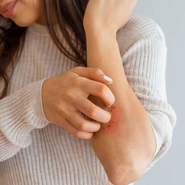 Böbrek yetmezliği kaşıntıda gizli