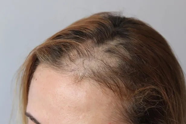 Kadın hasta hemşireyi darp etti! Önce küfürler savurdu sonra saçlarını yoldu-5