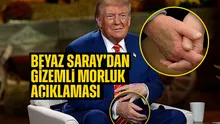Trump’ın elinde gizemli morluk! Söylentiler arttı: Beyaz Saray’dan ilginç açıklama