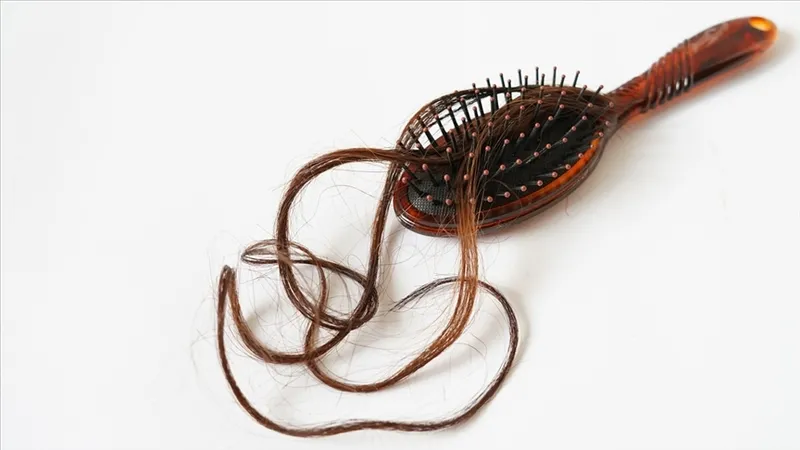 sac-dokulmesini-bicak-gibi-kesecek-1-damasi-bile-saci-halat-gibi-guclendirecek-1716581036233.jpg 1 damlası bile saçı halat gibi güçlendirecek! Saç dökülmesini bıçak gibi kesecek!-5