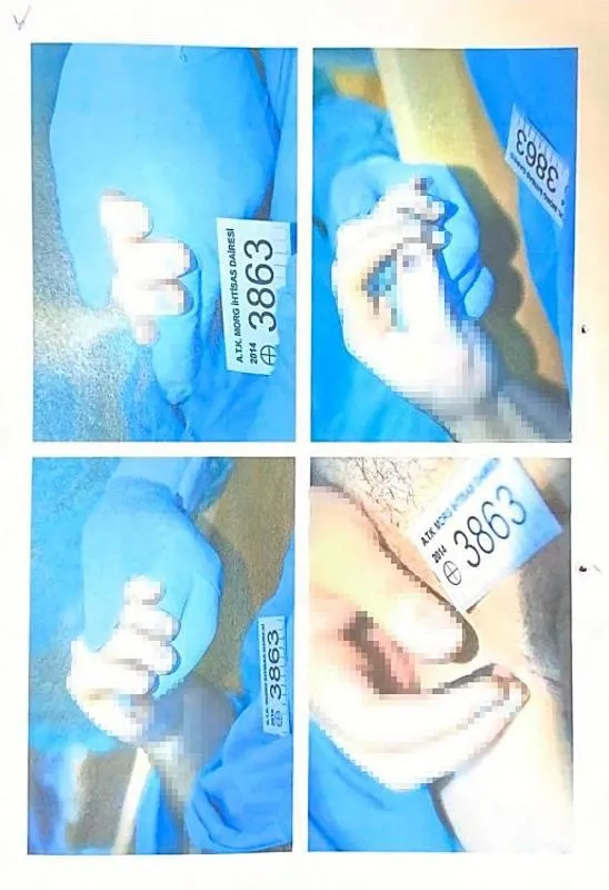 otopsi-fotograflari-sir-perdesini-kaldirmadi-cem-garipoglunun-mezari-acilacak-mi-nasil-teslim-olmustu-ilk-ifad-1714731666545.jpeg Otopsi fotoğrafları sır perdesini kaldırmadı! Cem Garipoğlu'nun mezarı açılacak mı? Nasıl teslim olmuştu? ilk ifadesinde ne demişti?-4