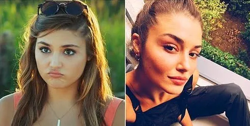 Hande Erçel'in estetiksiz hali harıl harıl doktor arattırıyor çok yaşa plastik cerrahi! Hande parayı bulunca yüzü değiştirmiş-9