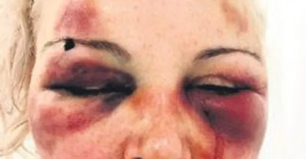 Rus Otteva Elvira, sosyal medya üzerinden otomotivci Alp Mutlu ile tanıştı: Hayatı kabusa döndü