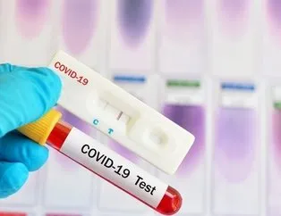 PCR testi nedir? PCR testi nasıl, nerede yapılır?