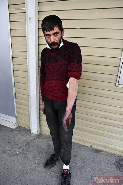 Gaziantep'te ikinci pitbull vakası! Saldırıya uğrayan talihsiz adam konuştu: "Kendimi kurtaramasam parçalayıp öldürürdü" - 5