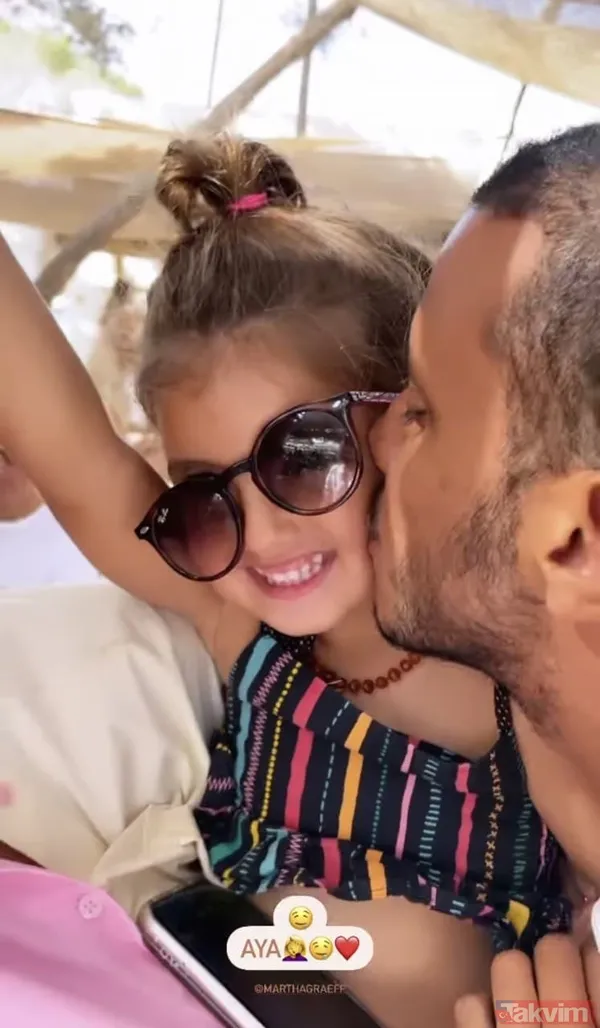 Acun Ilıcalı'nın yüzü gözü morluk içinde gören darp edildi sanıyor ama işin aslı başka! Estetik mi derken... - 44