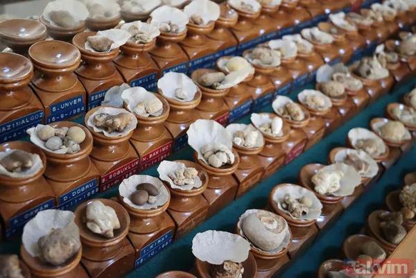 Üroloji doktorundan hayrete düşüren koleksiyon! Taşların kimisi 22 santim kimisi 650 gram - 1