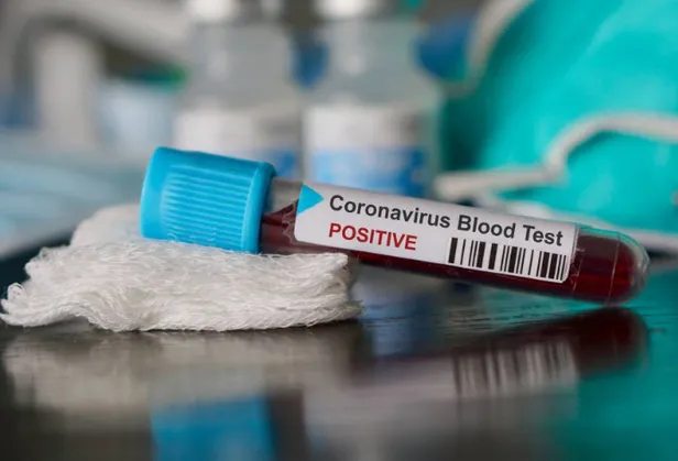 Koronavirüsten ölenler işte böyle defnediliyor!-1