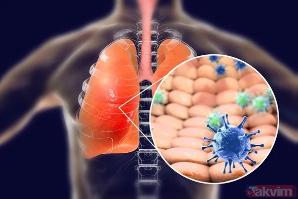 Bilim insanları açıkladı! İşte ilk günden son güne kadar koronavirüs belirtileri - 12