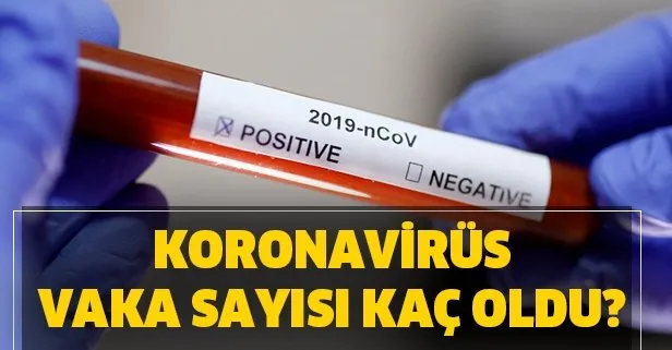 1 Nisan Türkiye'de corona virüs vaka ve ölü sayısı kaç?
