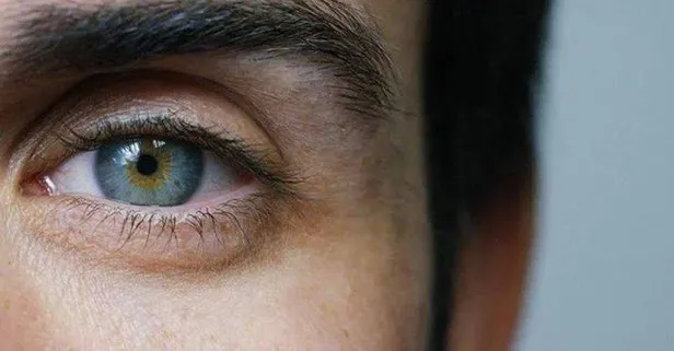 Sarı nokta hastalığı 50 yaşını bekliyor! Sarı nokta hastalığı nedir? | A’dan Z’ye göz sağlığı