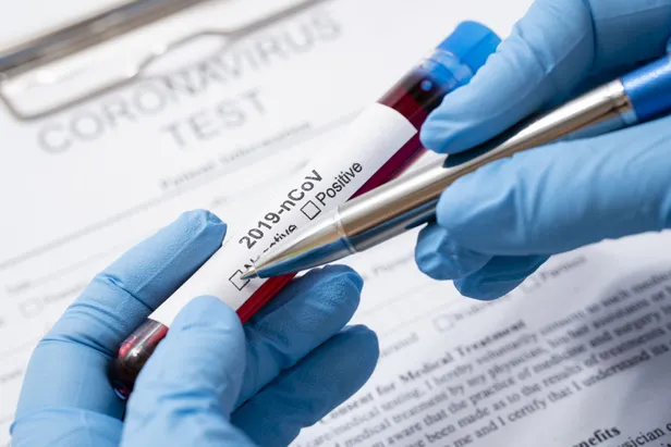 7-temmuz-korona-tablosu-corona-virus-vaka-ve-iyilesen-sayisi-kac-oldu-saglik-bakanligi-guncel-tablo-1594134864630.jpg 7 Temmuz korona tablosu: Corona virüs vaka ve iyileşen sayısı kaç oldu? Sağlık Bakanlığı güncel tablo-4