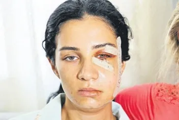 Adana’da şiddet mağduru genç kadın: Beni öldürmek istiyor