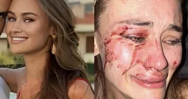 Şeyma Subaşının Ukraynalı model arkadaşı Daria Kyryliuk Çeşmede darp edildi! Olayla ilgili yeni gelişme...