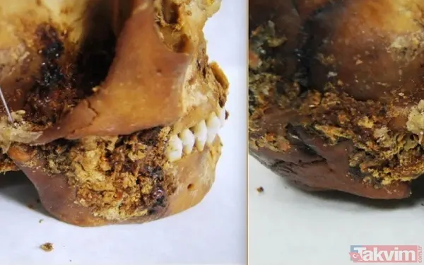 Antik çağın cerrahları: 2.500 yıllık mumyada at kılından yapılan protez keşfedildi - 9