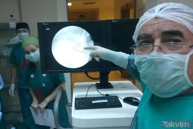 2 yaşındayken yuttu, 66 yıl sonra fark edildi