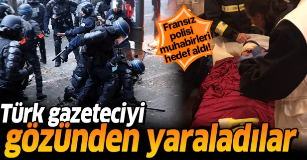 Paris’te polisin attığı gaz kapsülü Türk foto muhabirini yaraladı