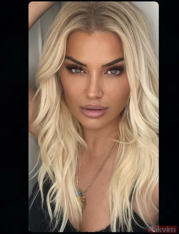 50’lik Songül Karlı estetiklerine yenisini ekledi! Onu artık telefonu bile tanımıyor! Hem Seda Sayan'a hem de Hadise'ye benzetildi - 3