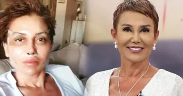 Seda Sayanın ipiyle kuyuya inen Serap Paköz şimdi tamam oldu! Serap Paköz başını ağrıtan estetik sonrası bambaşka biri!