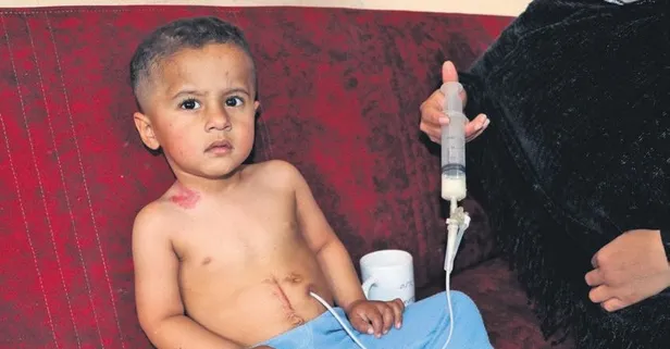 3 yaşındaki Muhammed Hüseyin için umutlu bekleyiş