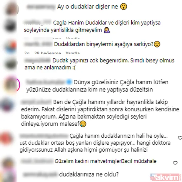 2 çocuk annesi Çağla Şıkel değişimiyle şaşırttı! Son halini görenler inanamadı! Tepkiler üst üste! “Güzelim kadını mahvetmişler...” - 6