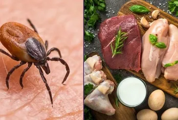 Kene ısırığıyla gelen gizemli alerji: Et ve süt yerken kaşınıyorsanız dikkat! Alpa-Gal sendromu hızla yayılıyor! 6 saat içinde...