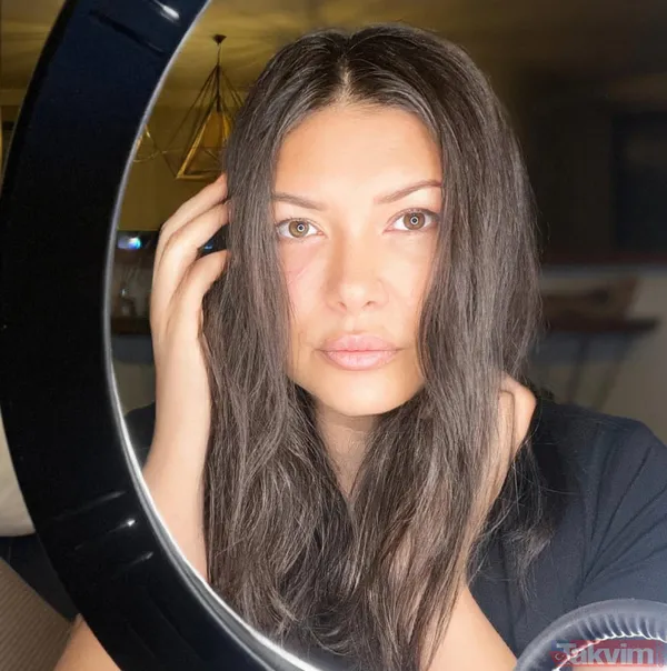 "8 kere imam 1 kere resmi nikahla evlendim" demişti! Rafet El Roman'ın eski eşi Tuğba Altıntop'un son haline bakın! Köpek saldırısına uğramıştı - 8