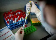 Son dakika: Sağlık Bakanı Fahrettin Koca açıkladı: 88 ülke Türkiyeden yardım istedi!