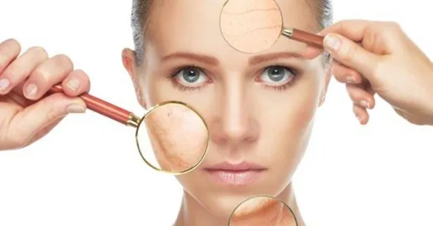 Uzmanı uyardı: Benler cilt kanserinin habercisi!