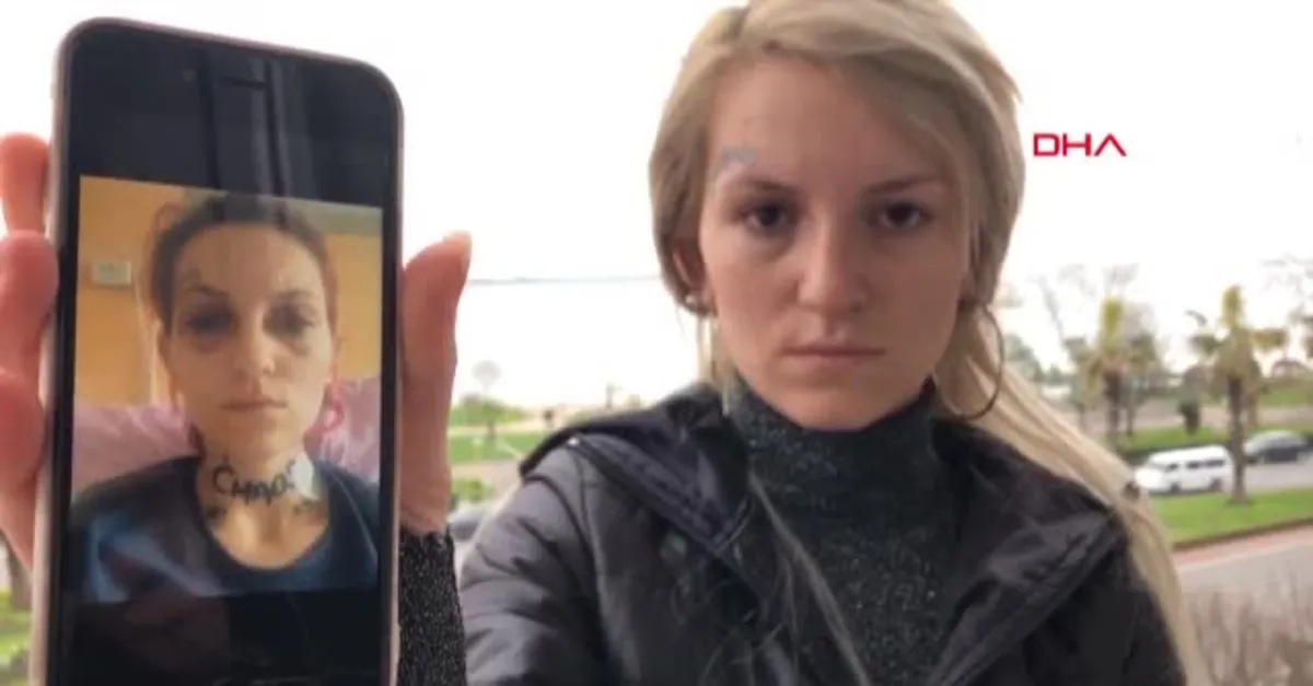 Zonguldak Ereğli'de Ufuk Özel'in 9 bıçak darbesiyle ağır yaraladığı Çağla Çiçekçi: İzleri her gördüğümde olay canlanıyor! Adalet yerini bulsun