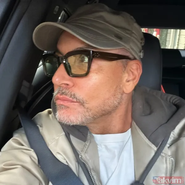 Cenk Eren’den estetik açıklaması: Aynalarla arası bozulunca soluğu doktorda aldı! - 5