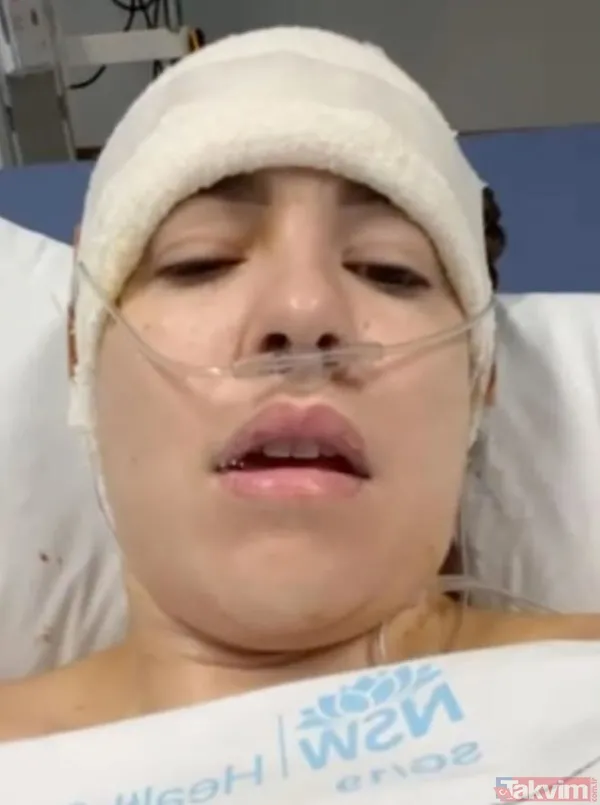 Ameliyattan çıkar çıkmaz fotoğraf paylaştı! Çılgın model sınırları zorladı! Cinsel fotoğraf... - 4