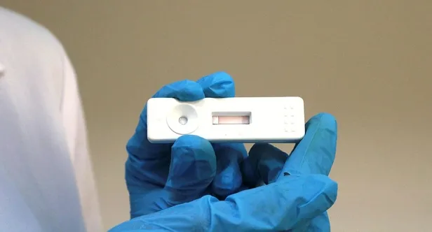 dunyada-bir-ilk-comude-gelistirilen-koronavirus-tani-kiti-8-dakikada-sonuc-veriyor-1599588380154.jpeg Dünyada bir ilk! ÇOMÜ'de geliştirilen koronavirüs tanı kiti 8 dakikada sonuç veriyor...-2