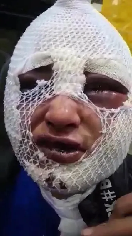 gorulmemis-vahset-eski-sozlusunu-dovdu-cinsel-saldirida-bulundu-kizgin-yag-doktu-1639668434349.jpg Görülmemiş vahşet! Eski sözlüsünü dövdü cinsel saldırıda bulundu kızgın yağ döktü-2