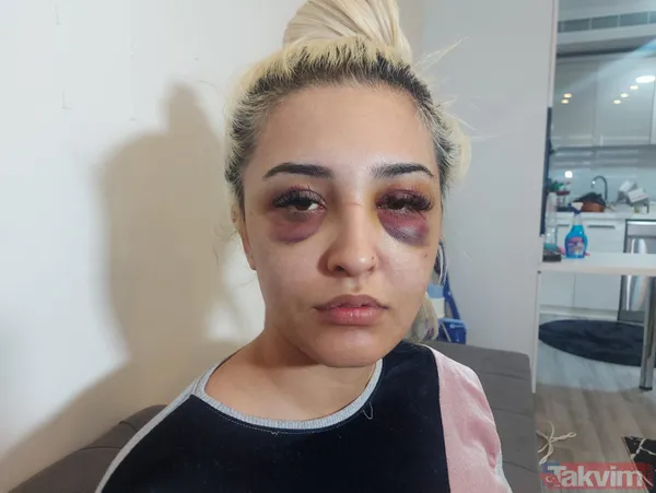 Eski sevgilisine dehşeti yaşattı: Ayrılmayı kabul etmedi 3 saat boyunca darp ederek tanınmaz hale getirdi! - 7