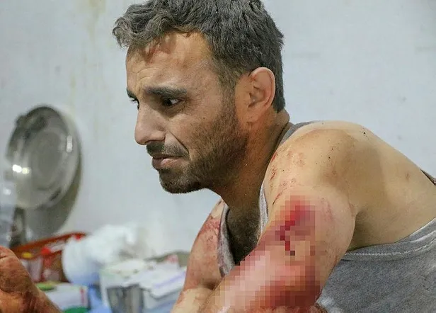 Son dakika: Esed rejiminden İdlib kırsalında katliam: 8 sivil hayatını kaybetti, 9 sivil yaralandı!-5