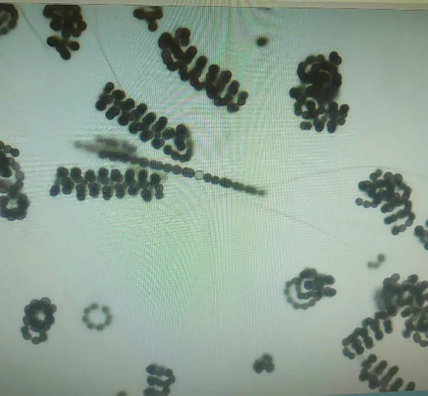 siyanobakteri-nedir-neden-olur-siyanobakteri-zararlari-nedir-istanbul-sazlidere-barajinda-siyanobakteri-alarmi-1657886724983.jpg Siyanobakteri zararları nedir? Siyanobakteri nedir, neden olur? İstanbul Sazlıdere Barajı'nda siyanobakteri alarmı!-4