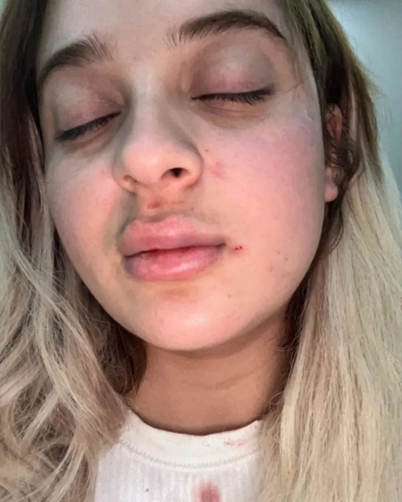 Esenyurt'ta sevgili dehşeti (DHA)